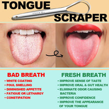 Load image into Gallery viewer, [2PKS] KN FLAX Tongue Scraper with Cases | Medical Grade