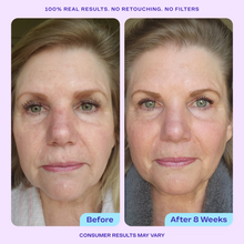 Load image into Gallery viewer, GOPURE Anti Wrinkle Moisturizer