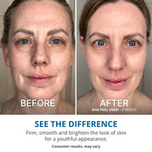 Load image into Gallery viewer, GOPURE Wake Up Radiant AHA Peel