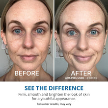 Load image into Gallery viewer, GOPURE Wake Up Radiant AHA Peel