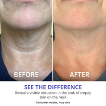 Load image into Gallery viewer, GOPURE Tighten &amp; Lift Neck Cream 2 Jars