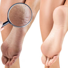 Load image into Gallery viewer, Crocodile Killer Dry Skin Pudding - Coconut Lemongrass (3 sizes)