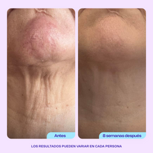 Load image into Gallery viewer, GOPURE Neck Cream - Tighten &amp; Lift Firming Neck Cream for Crepey Skin